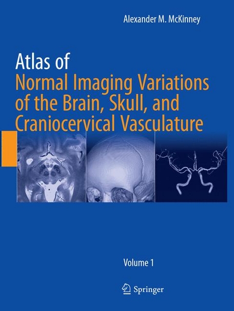 Atlas of Normal Imaging Variations of the Brain, Skull, and Craniocervical Vasculature - Alexander M. McKinney