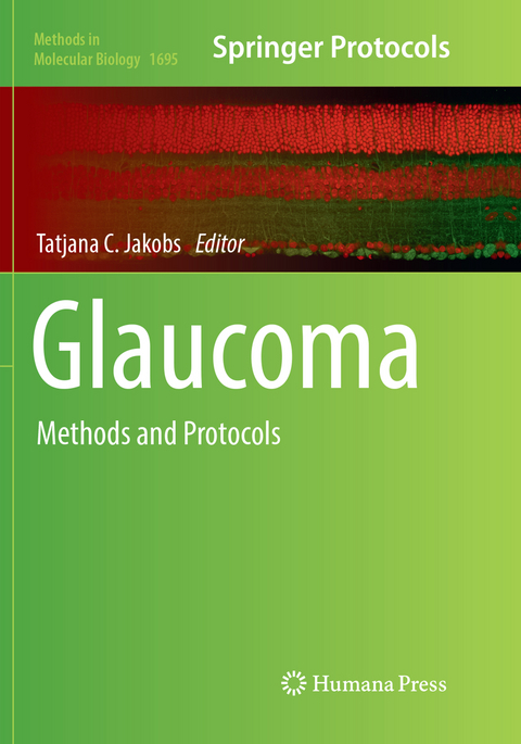 Glaucoma - 