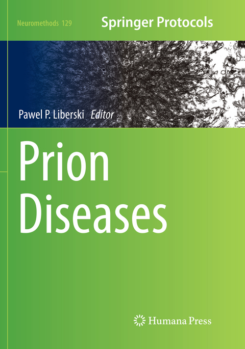 Prion Diseases - 