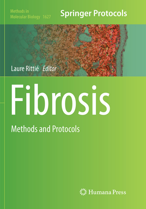 Fibrosis - 