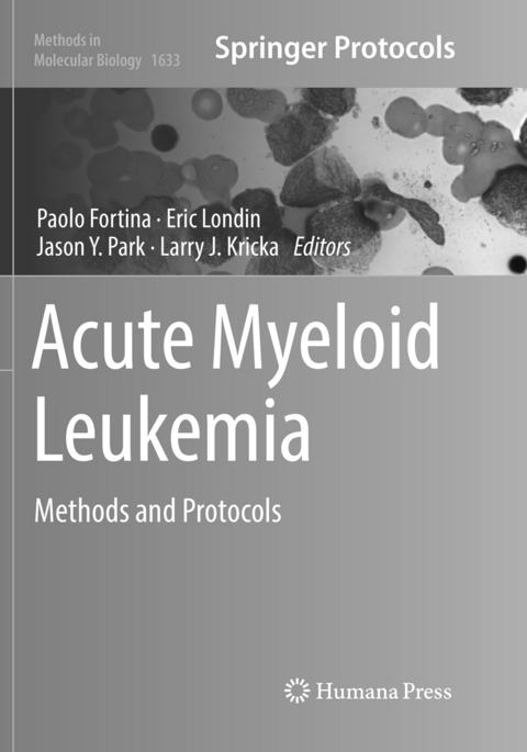 Acute Myeloid Leukemia - 