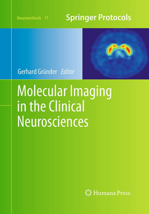 Molecular Imaging in the Clinical Neurosciences - 