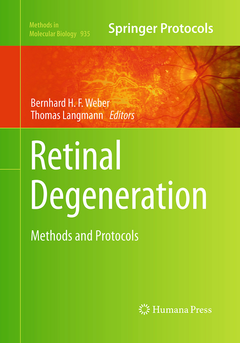 Retinal Degeneration - 