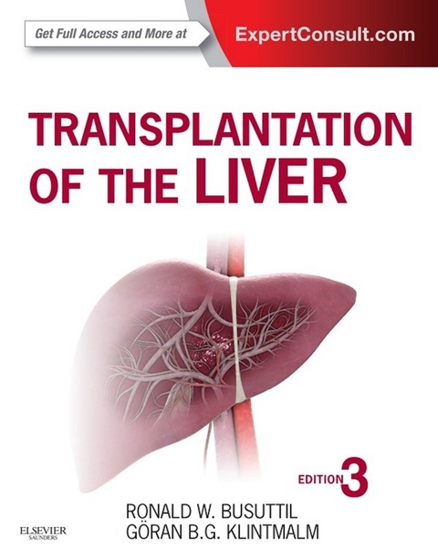 Transplantation of the Liver -  Ronald W. Busuttil,  Goran B. Klintmalm