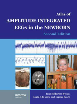 Atlas of Amplitude-Integrated EEGs in the Newborn - 