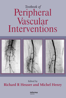 Textbook of Peripheral Vascular Interventions - 