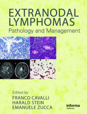 Extranodal Lymphomas - 