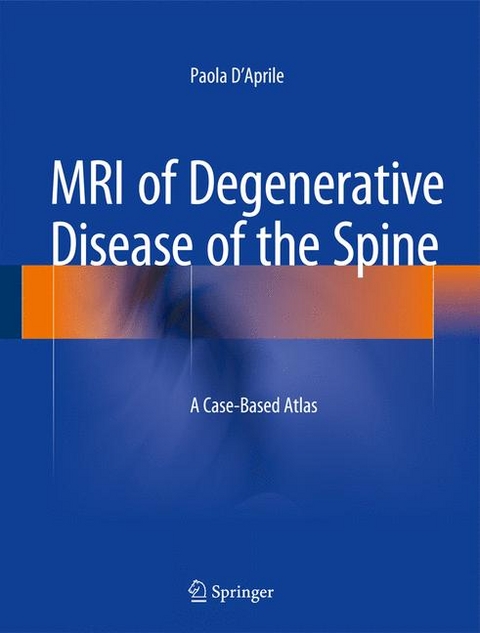 MRI of Degenerative Disease of the Spine - Paola D'Aprile