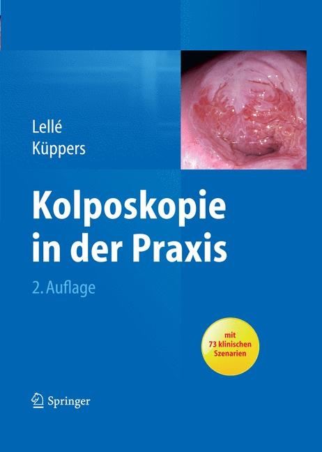 Kolposkopie in der Praxis - Ralph J. Lellé, Volkmar Küppers