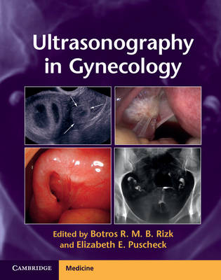 Ultrasonography in Gynecology - 