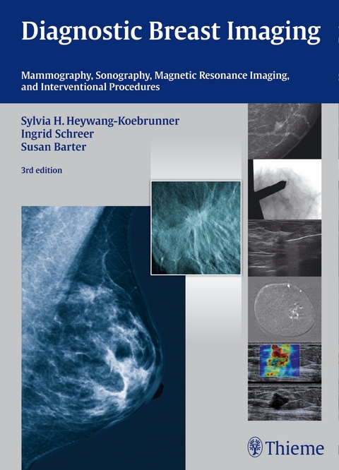 Diagnostic Breast Imaging - Sylvia H. Heywang-Köbrunner, Ingrid Schreer, Susan Barter