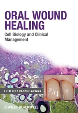 Oral Wound Healing - 