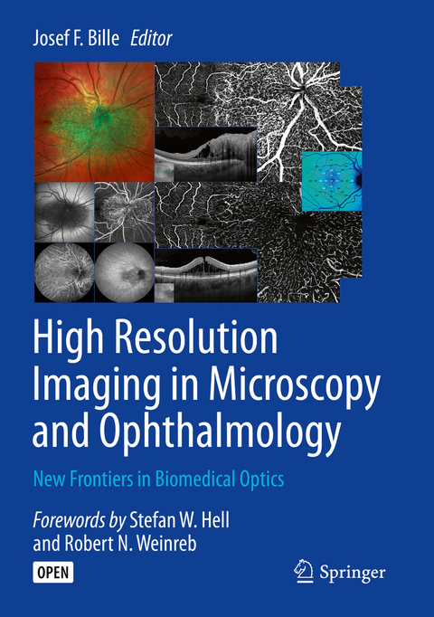 High Resolution Imaging in Microscopy and Ophthalmology - 