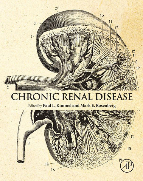 Chronic Renal Disease - 