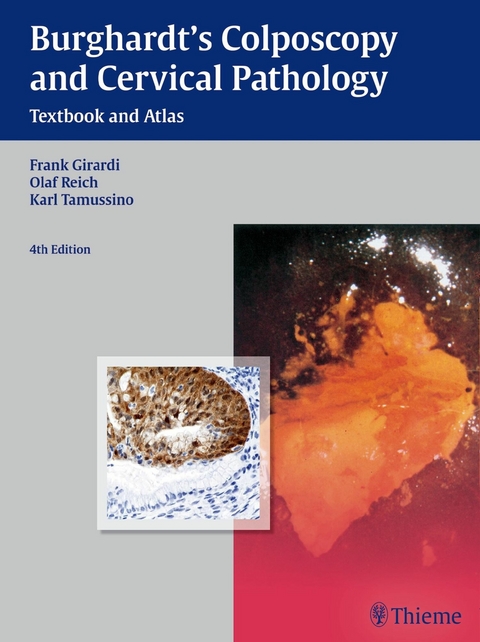 Burghardt's Colposcopy and Cervical Pathology - Erich Burghardt, Frank Girardi, Olaf Reich, Karl Tamussino, Hellmuth Pickel