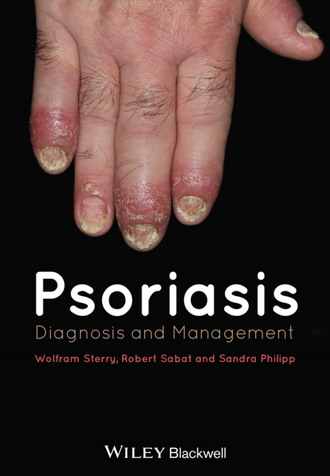 Psoriasis - 