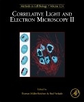 Correlative Light and Electron Microscopy II - 