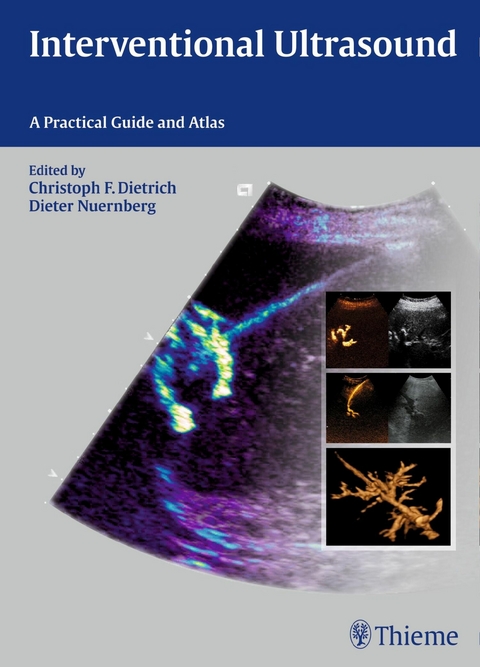 Interventional Ultrasound -  Dieter Nürnberg,  Christoph Frank Dietrich