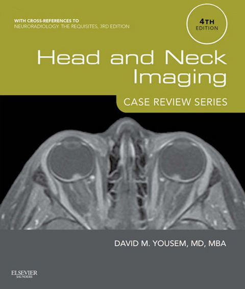 Head and Neck Imaging: Case Review Series E-Book -  David M. Yousem