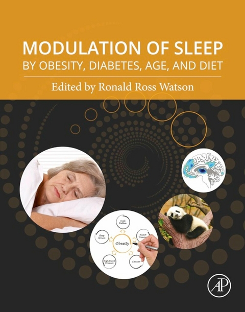 Modulation of Sleep by Obesity, Diabetes, Age, and Diet - 