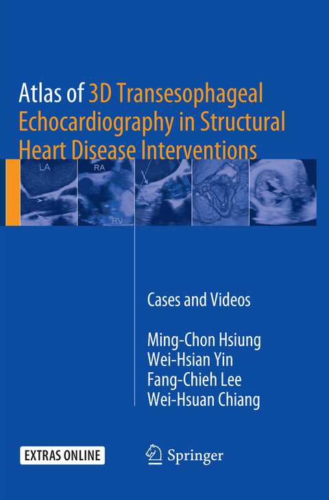 Atlas of 3D Transesophageal Echocardiography in Structural Heart Disease Interventions - Ming-Chon Hsiung, Wei-Hsian Yin, Fang-Chieh Lee, Wei-Hsuan Chiang