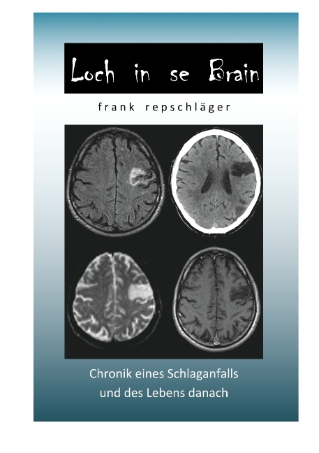 Loch in se Brain - Frank Repschläger