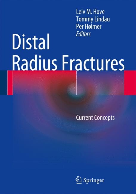 Distal Radius Fractures - 