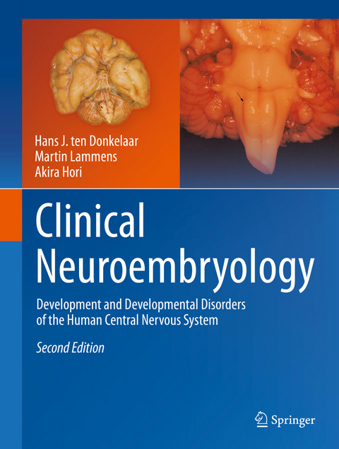 Clinical Neuroembryology - Hans J. ten Donkelaar, Martin Lammens, Akira Hori