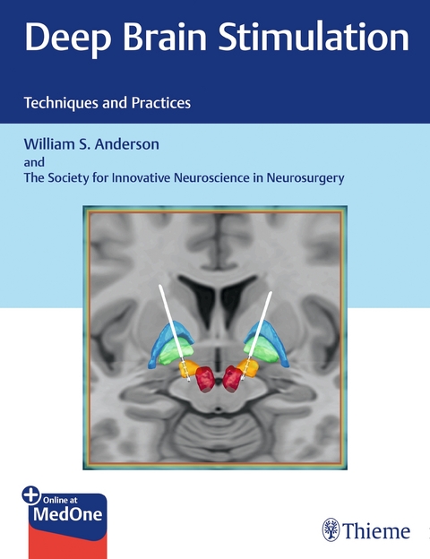 Deep Brain Stimulation - William Anderson