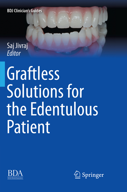 Graftless Solutions for the Edentulous Patient - 