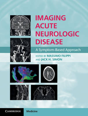 Imaging Acute Neurologic Disease - 