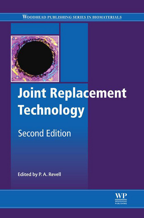 Joint Replacement Technology - 