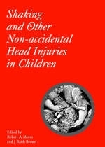 Shaking and Other Non-Acccidental Head Injuries in Children - 