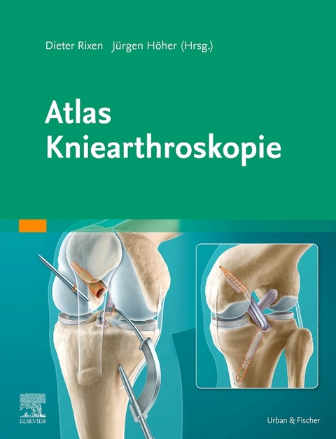 Atlas Kniearthroskopie - 