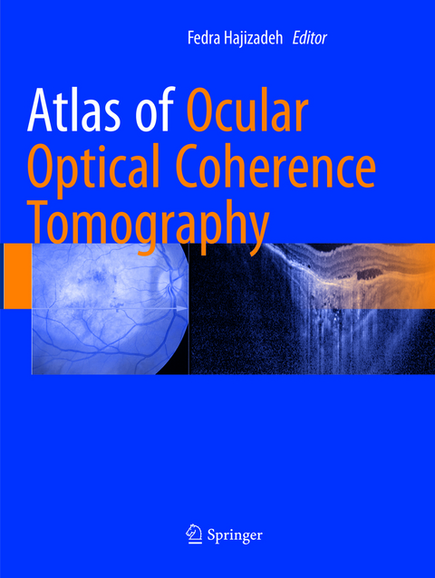 Atlas of Ocular Optical Coherence Tomography - 