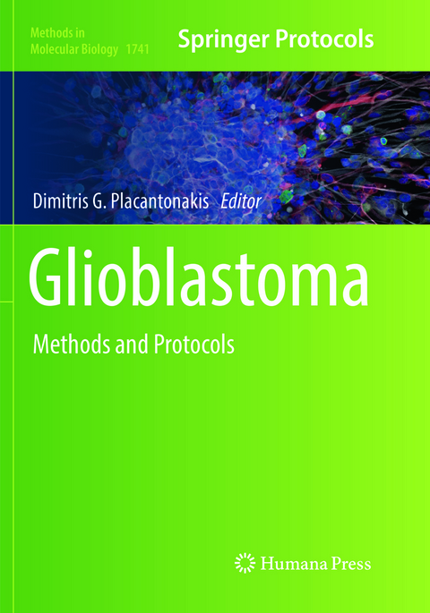 Glioblastoma - 