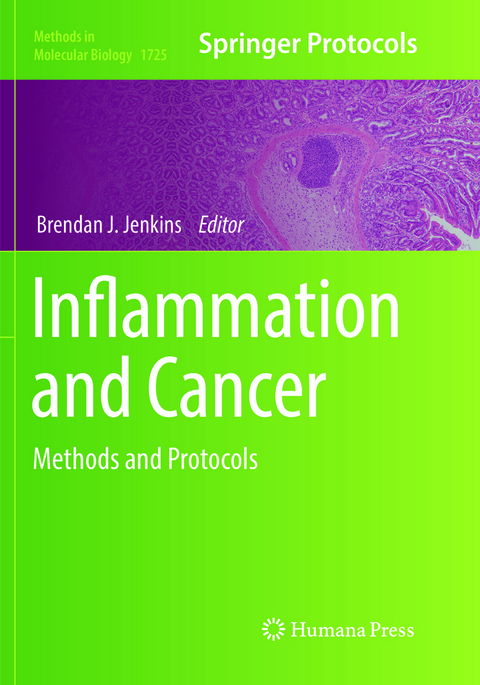 Inflammation and Cancer - 