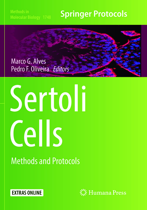 Sertoli Cells - 