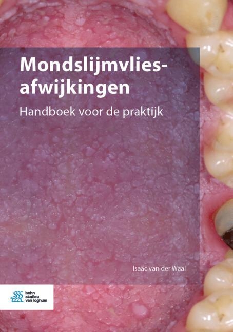 Mondslijmvliesafwijkingen - Isaäc van der Waal