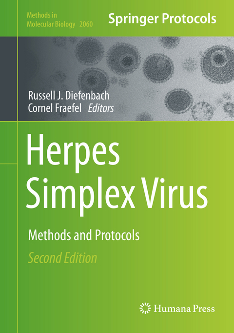 Herpes Simplex Virus - 