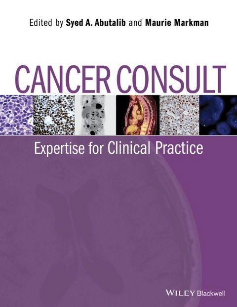 Cancer Consult - 