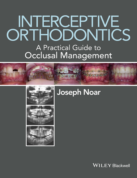 Interceptive Orthodontics -  Joseph Noar