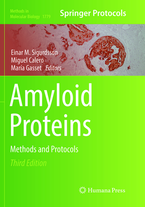 Amyloid Proteins - 