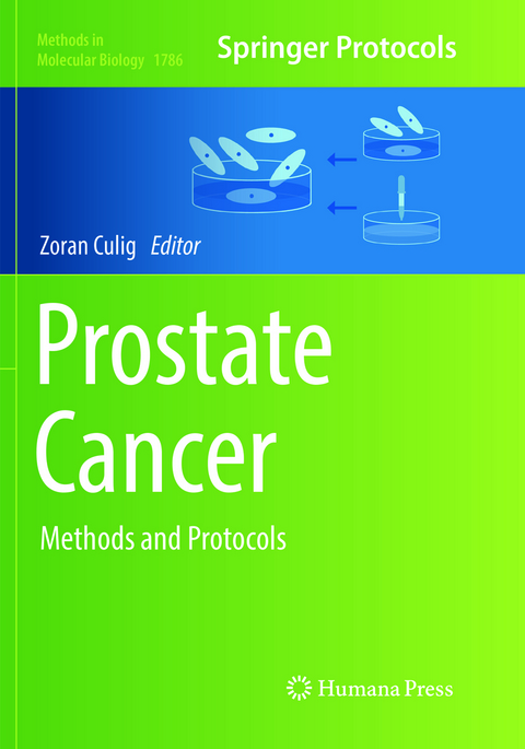 Prostate Cancer - 