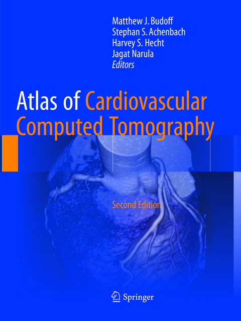 Atlas of Cardiovascular Computed Tomography - 