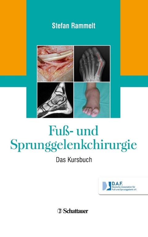 Fuß- und Sprunggelenkchirurgie - 