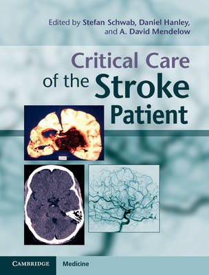 Critical Care of the Stroke Patient - 