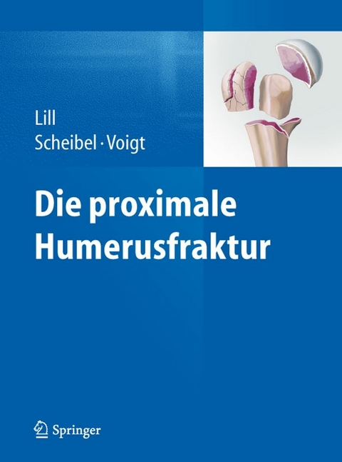 Die proximale Humerusfraktur - 