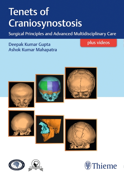 Tenets of Craniosynostosis - 