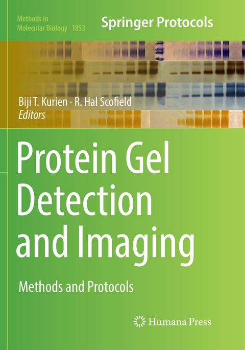 Protein Gel Detection and Imaging - 